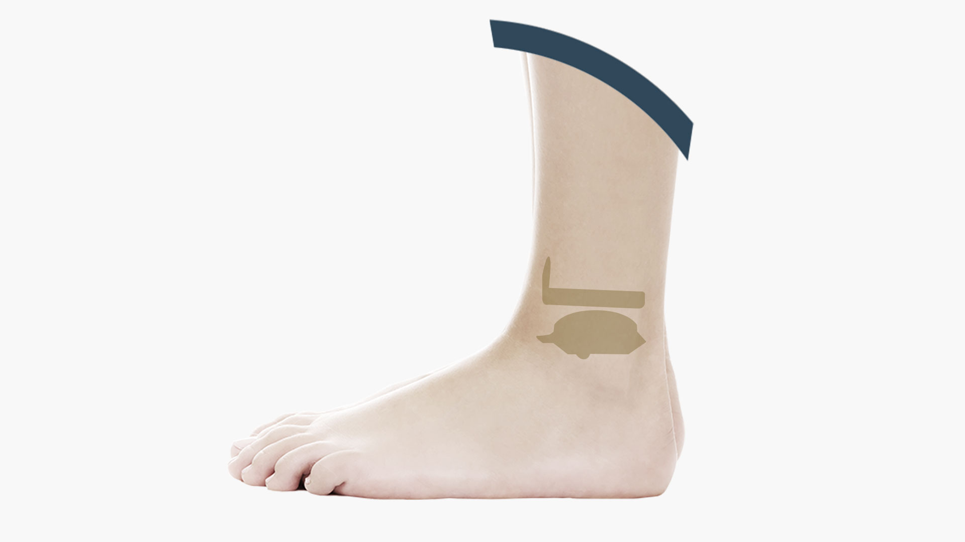 Ankle prosthesis mobile bearing
